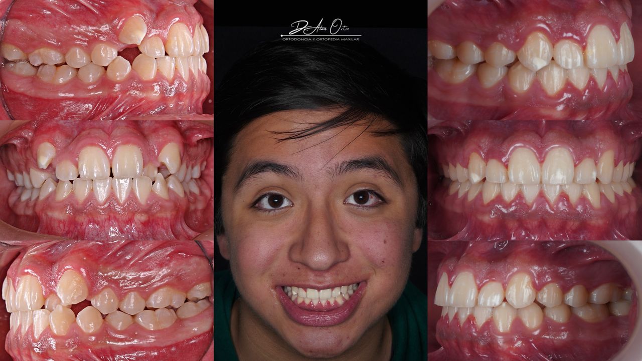 Alan Ortiz-8