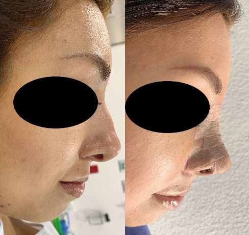 J. Antonio Meré Gómez-17