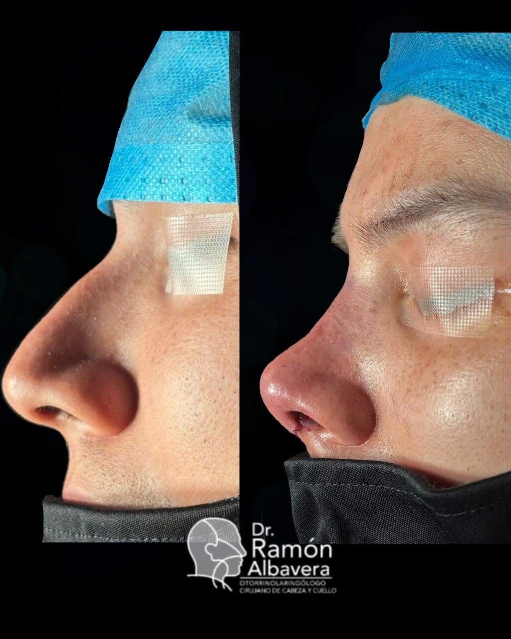 Luis Ramón Albavera Giles-1