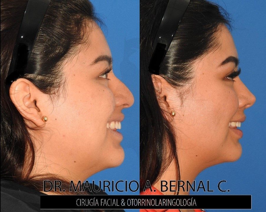 Mauricio Alejandro Bernal Carreon-20