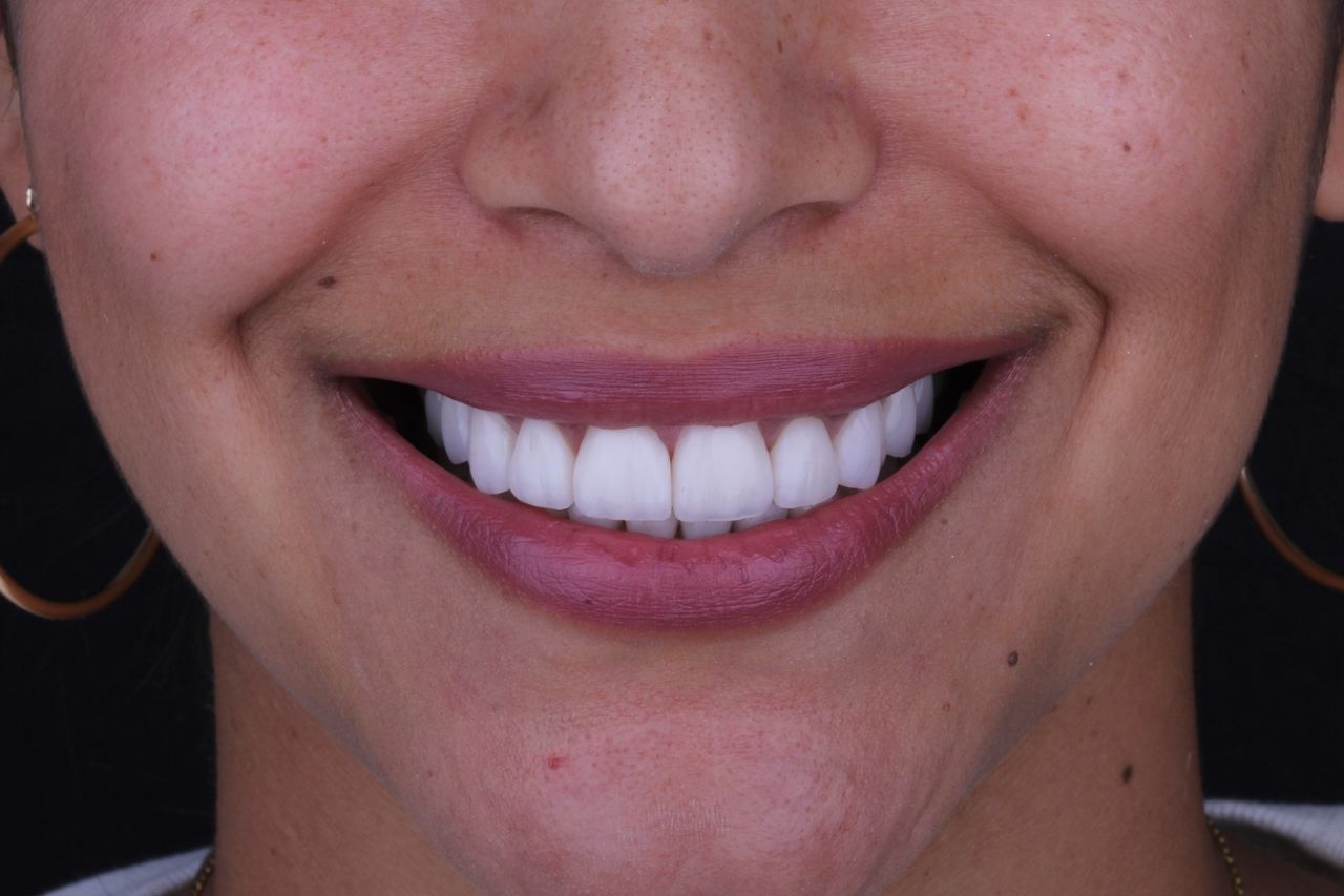 Josué Márquez Gómez-111