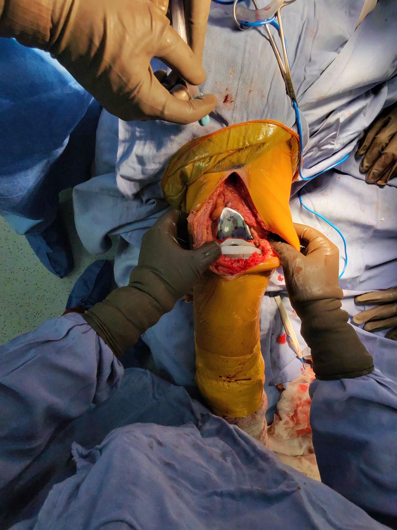 Cristian Ernesto Murillo Medina-25