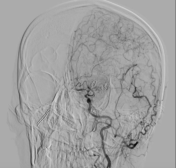 Edgar Fernando Acosta Gomez-8