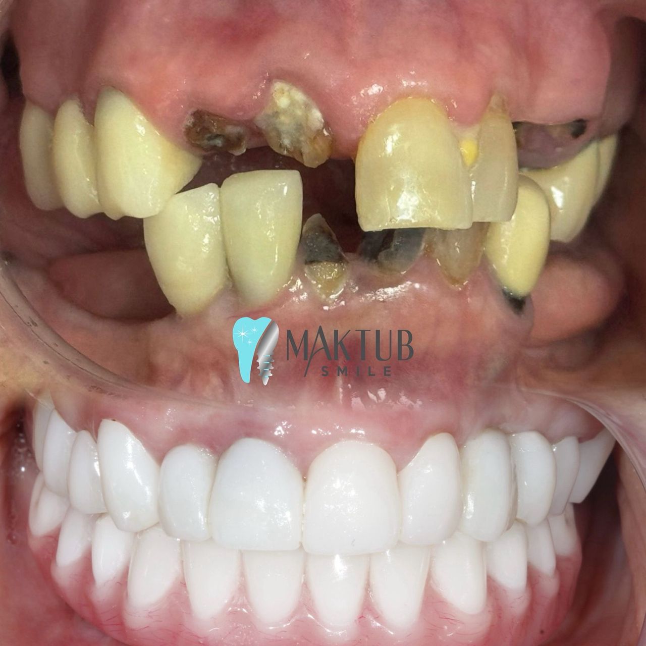 Nairoby Contreras-26