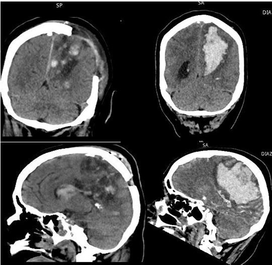 Marco Antonio Díaz Montoya-1