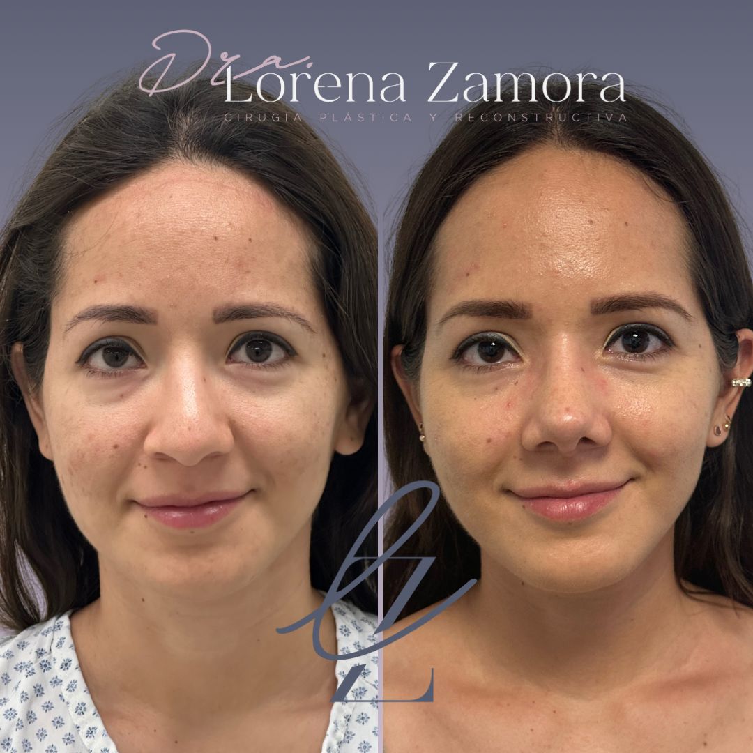 Lorena Zamora Pérez-0