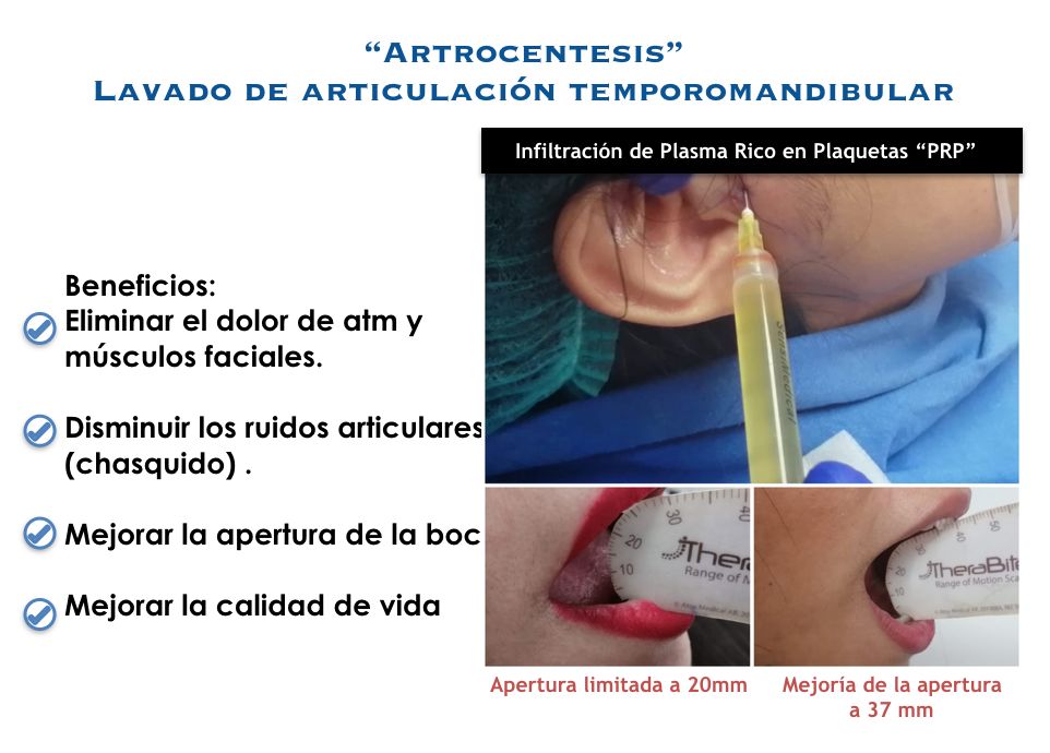 Giovani Ramírez Limón-44