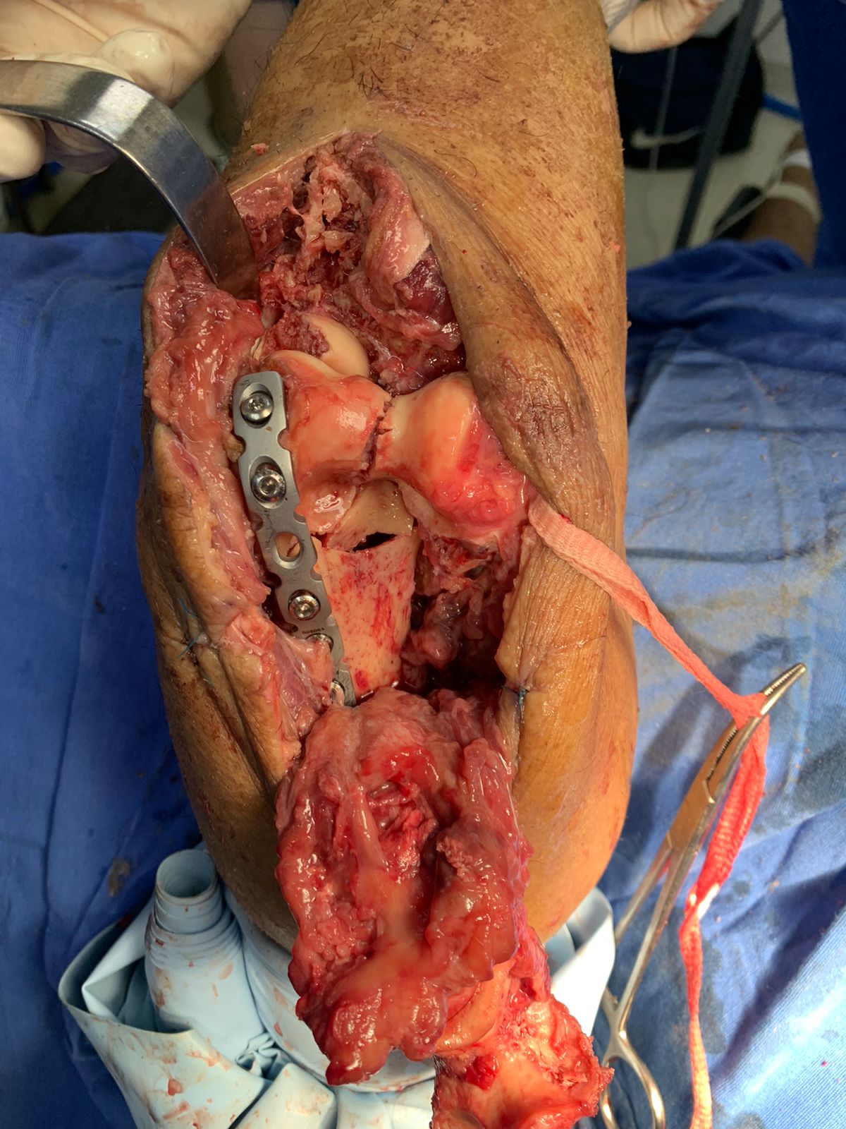 Francisco Sandoval Pérez-11