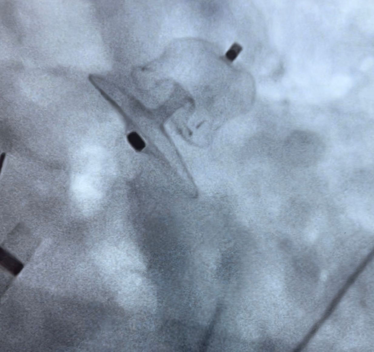 Abdón Ávila Chávez-8