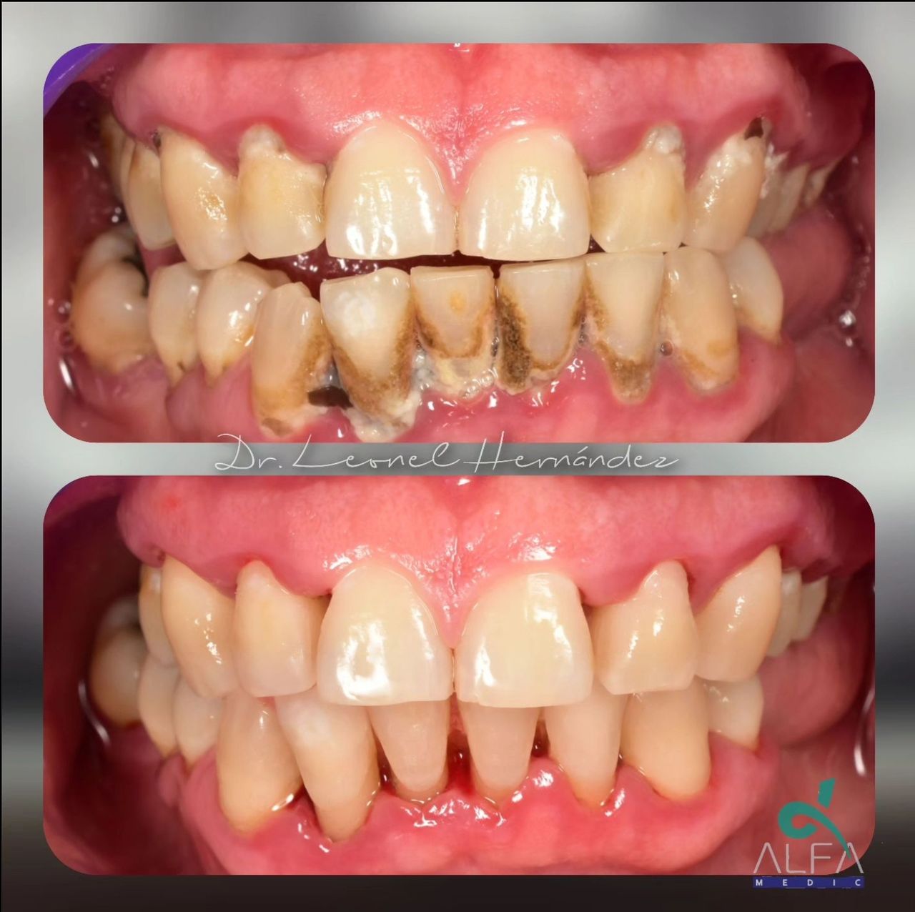 Leonel Hernández Gómez-11