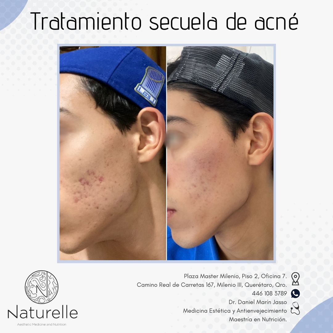 Daniel Marín Jasso-13