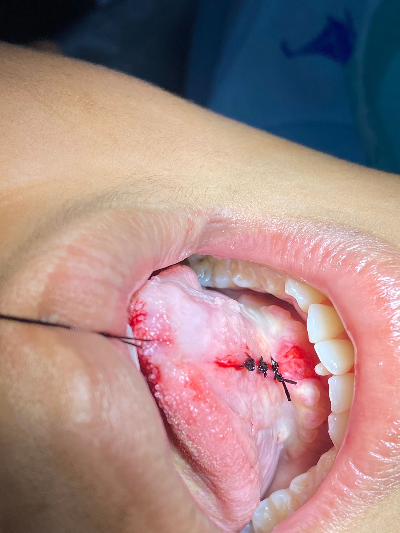 Rigoberto Garrido Dionisio-3