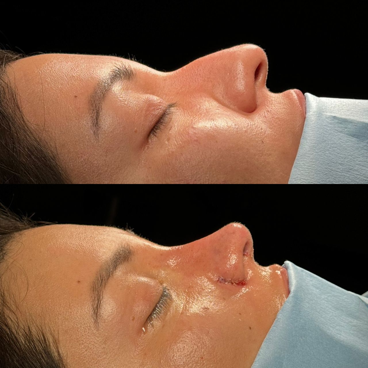 Angel Castro Urquizo-85