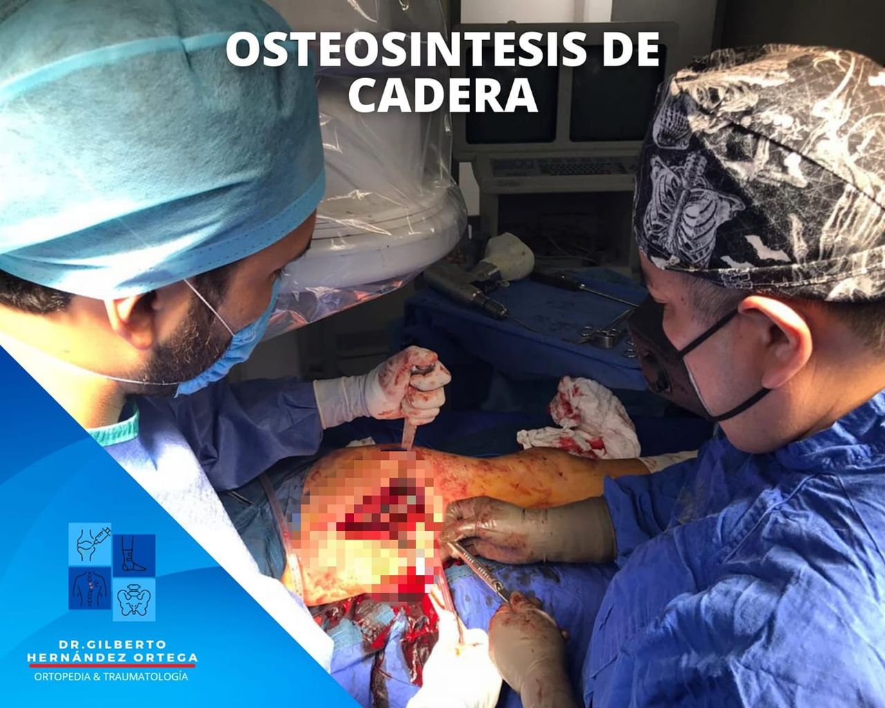 Gilberto Hernández Ortega-33