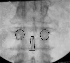 Enrique De Obieta Cruz-43