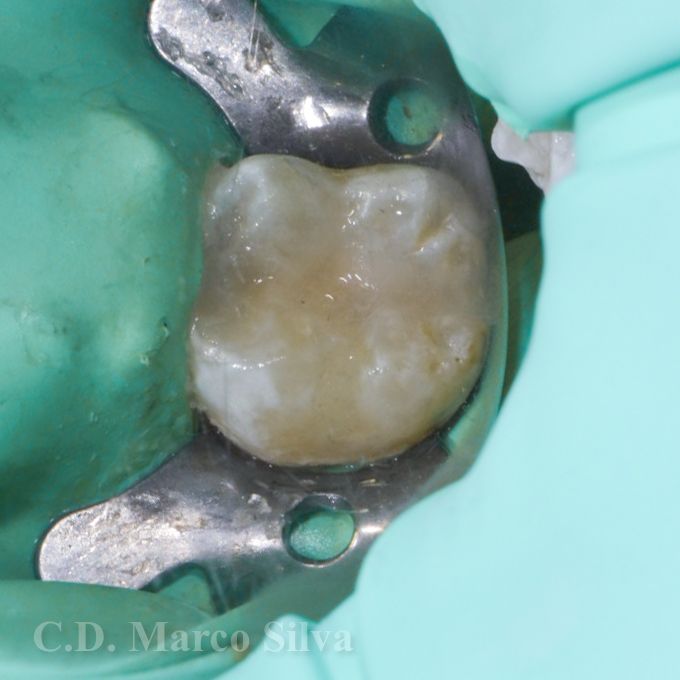 Marco Antonio Silva-16