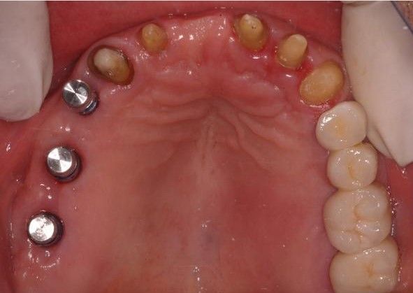 José Alberto Martínez Basulto-17