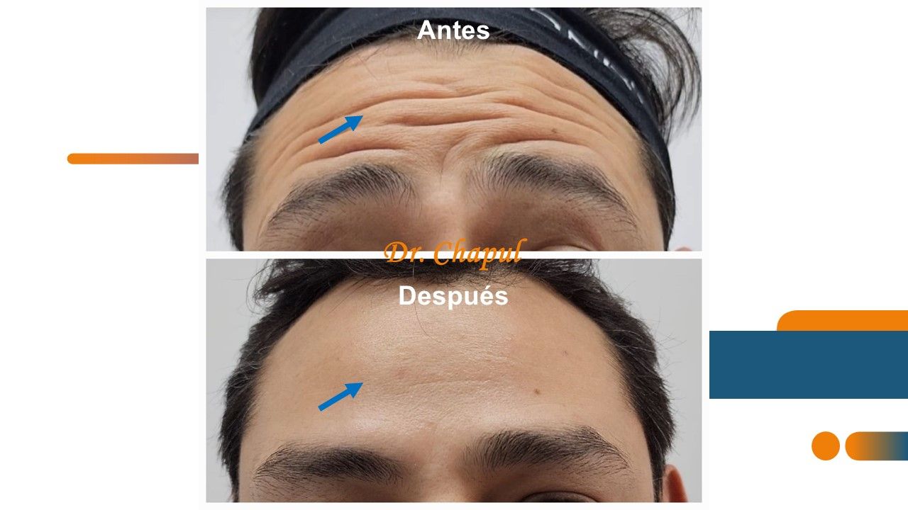 José Luis Muñoz Chapul-28