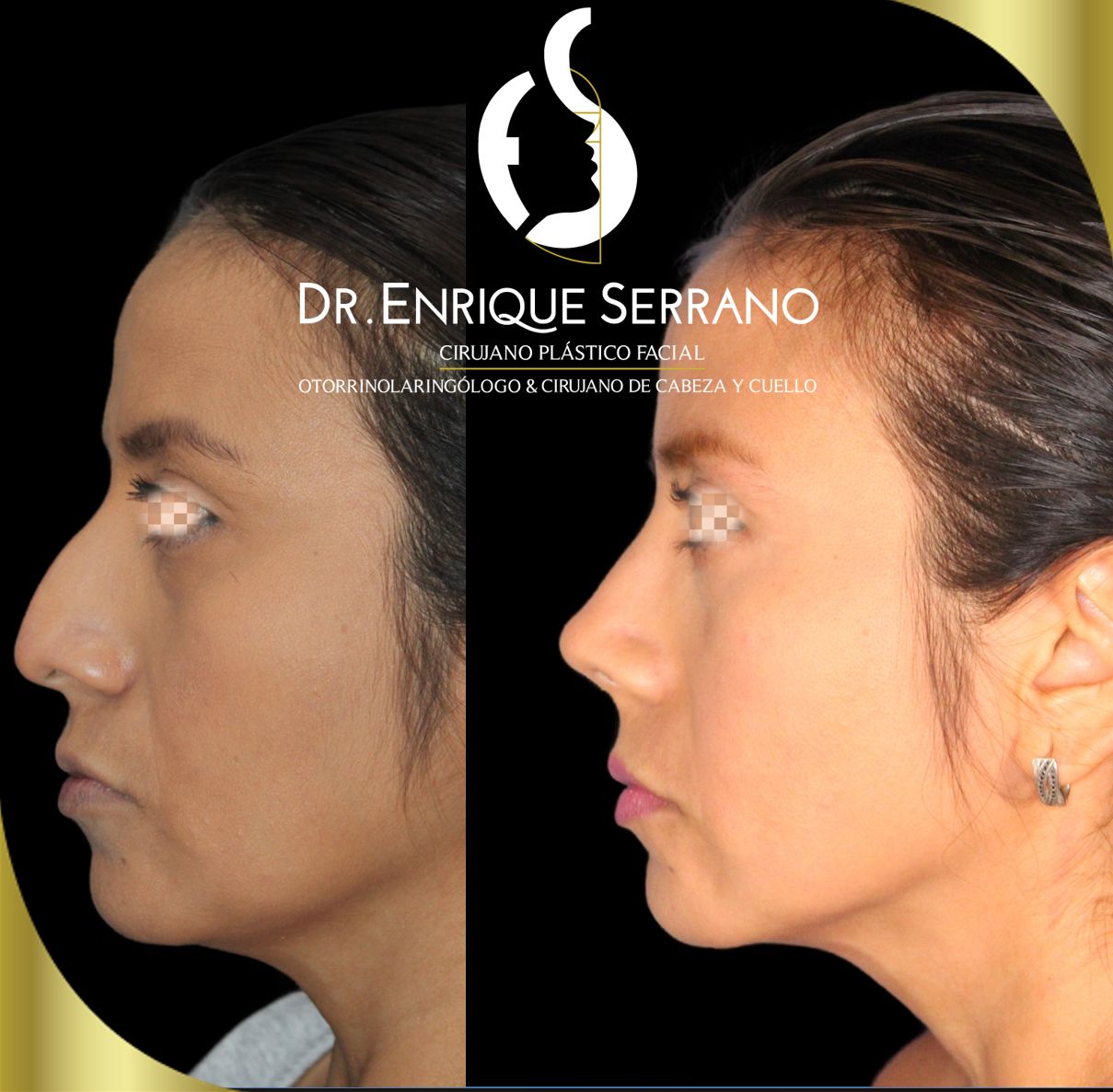 Enrique Serrano Cruz-9