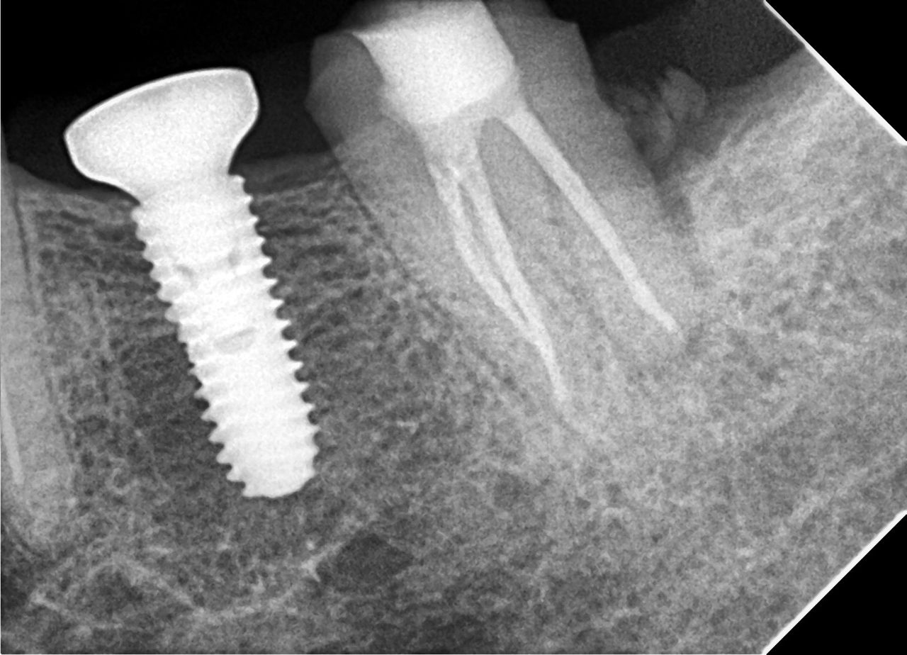 Andrés Tovar López-13