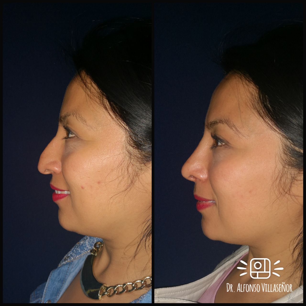 Alfonso Villaseñor Herrero-27