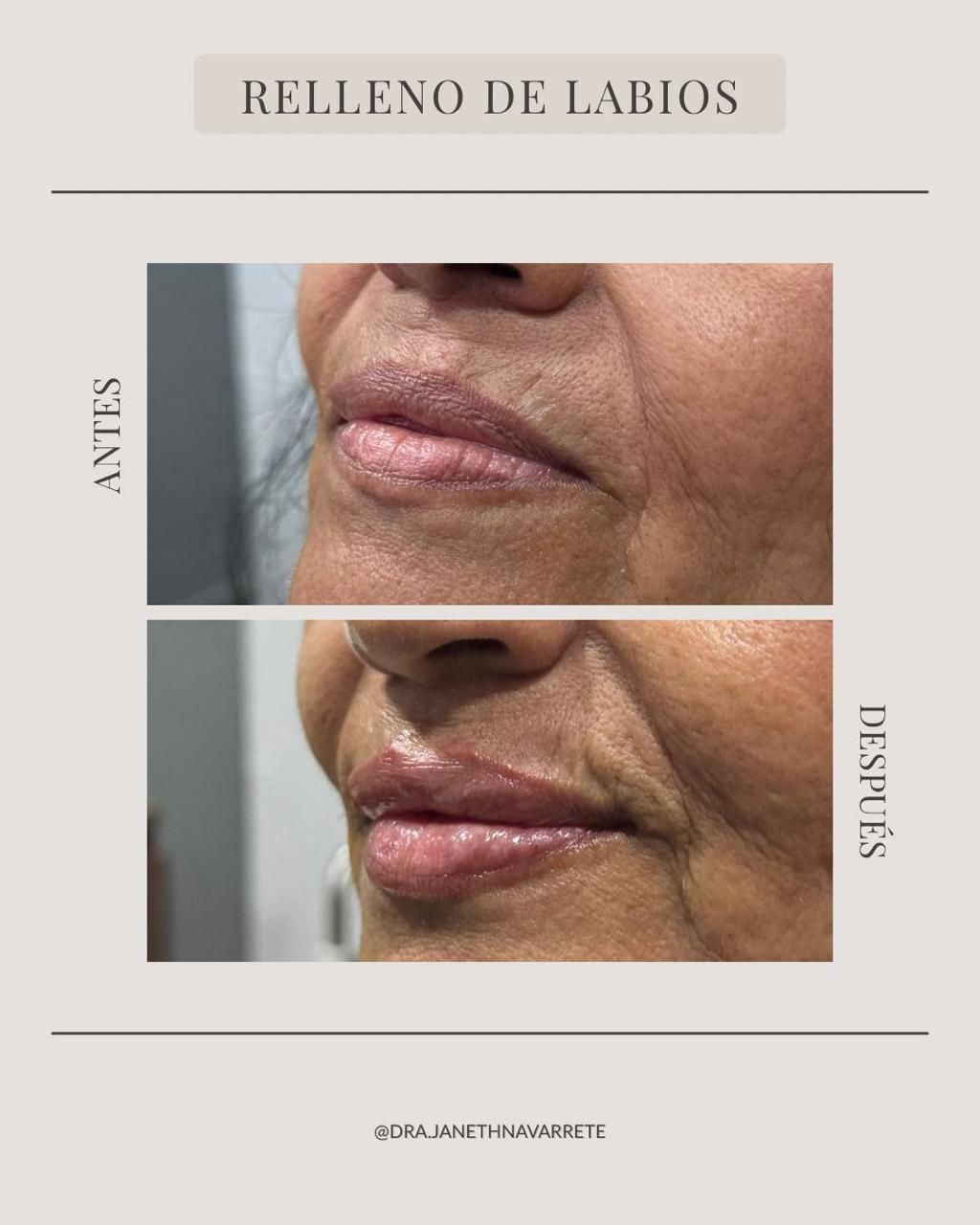 Janeth Navarrete Godinez-0