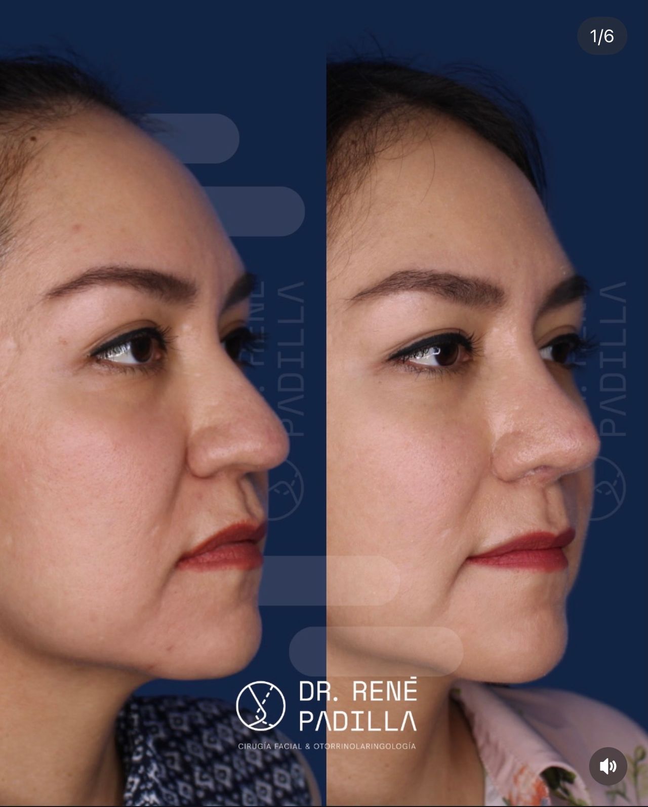 René Emmanuel Padilla López-4