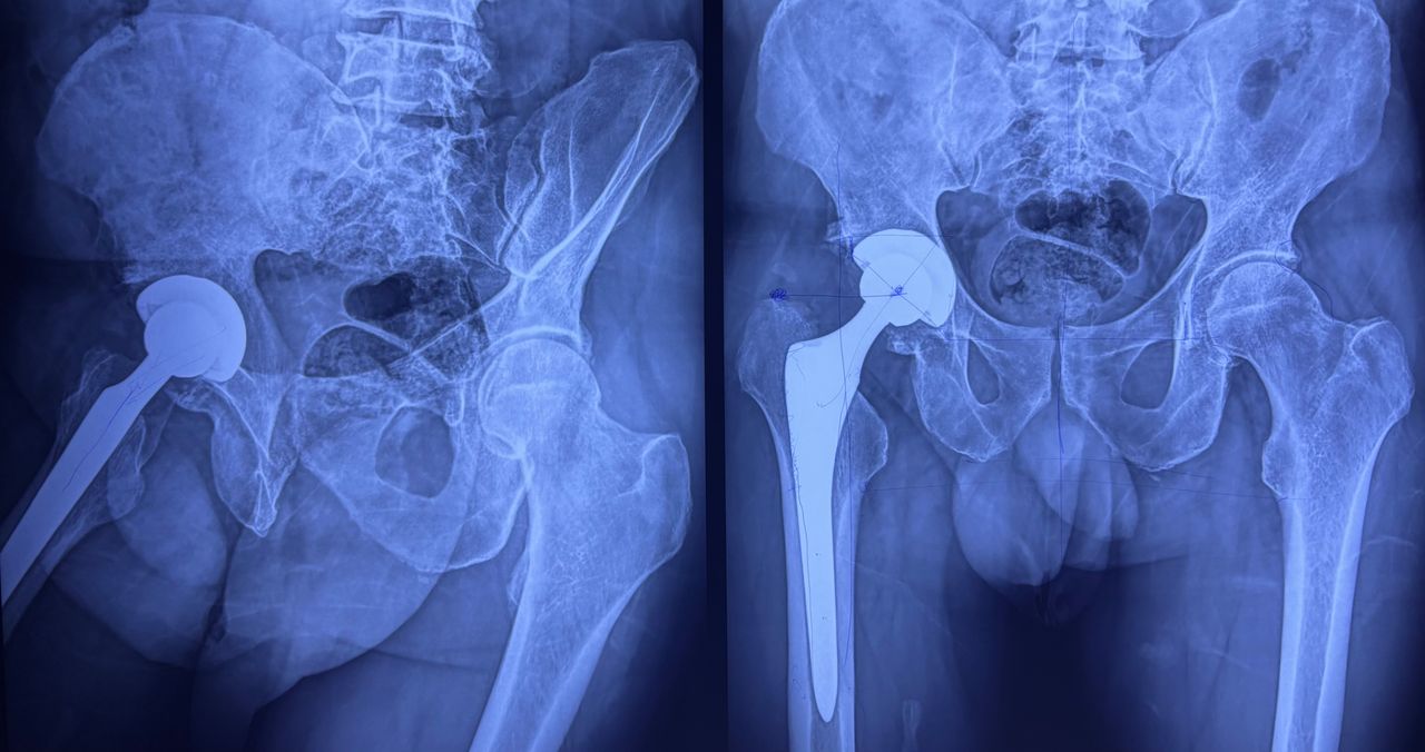 Josué Jonatan Arcia Guzmán-13