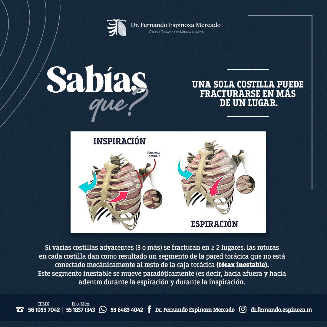 Fernando Espinoza Mercado-12