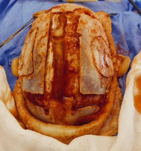 Dr. José David Cuenca Rivas-3