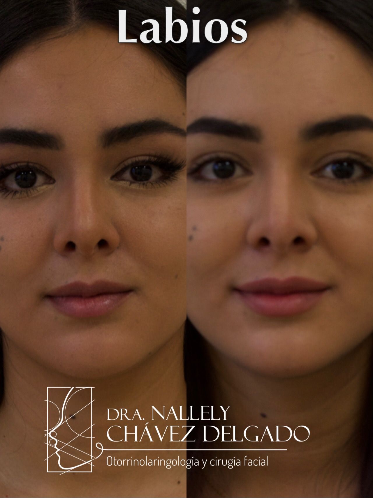 Nallely Chávez Delgado-1