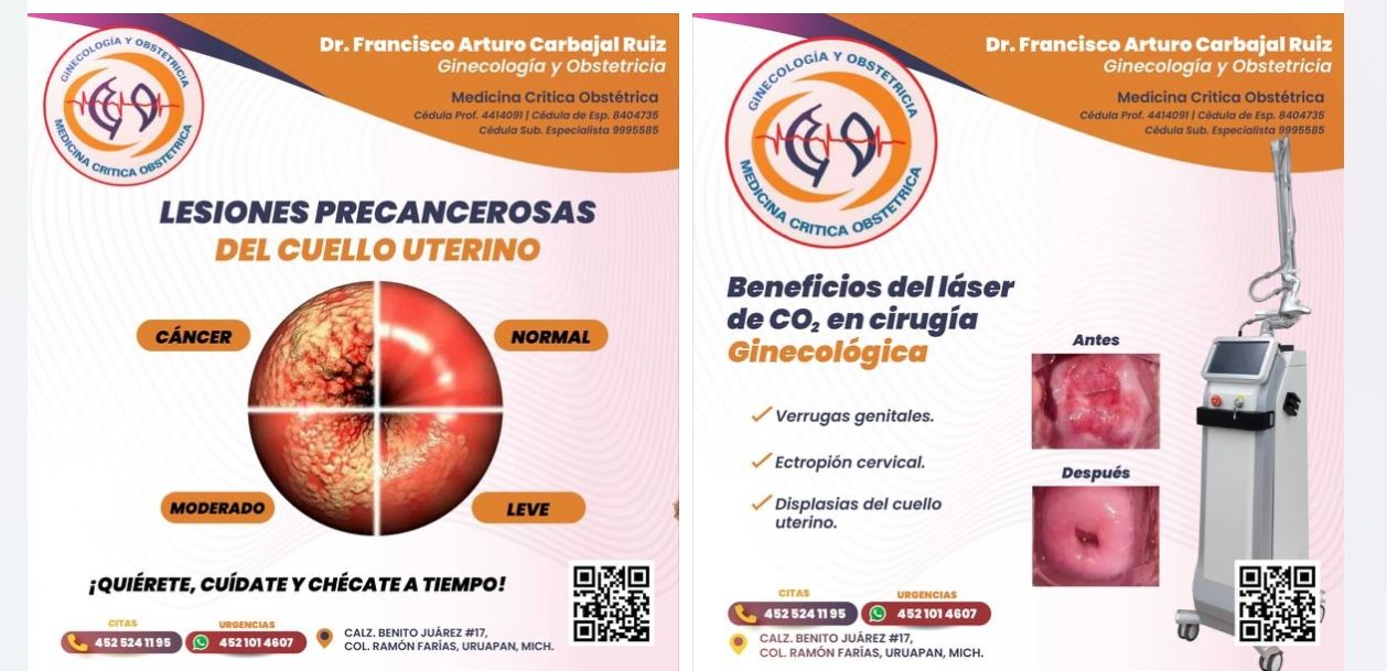 Francisco Carbajal-104