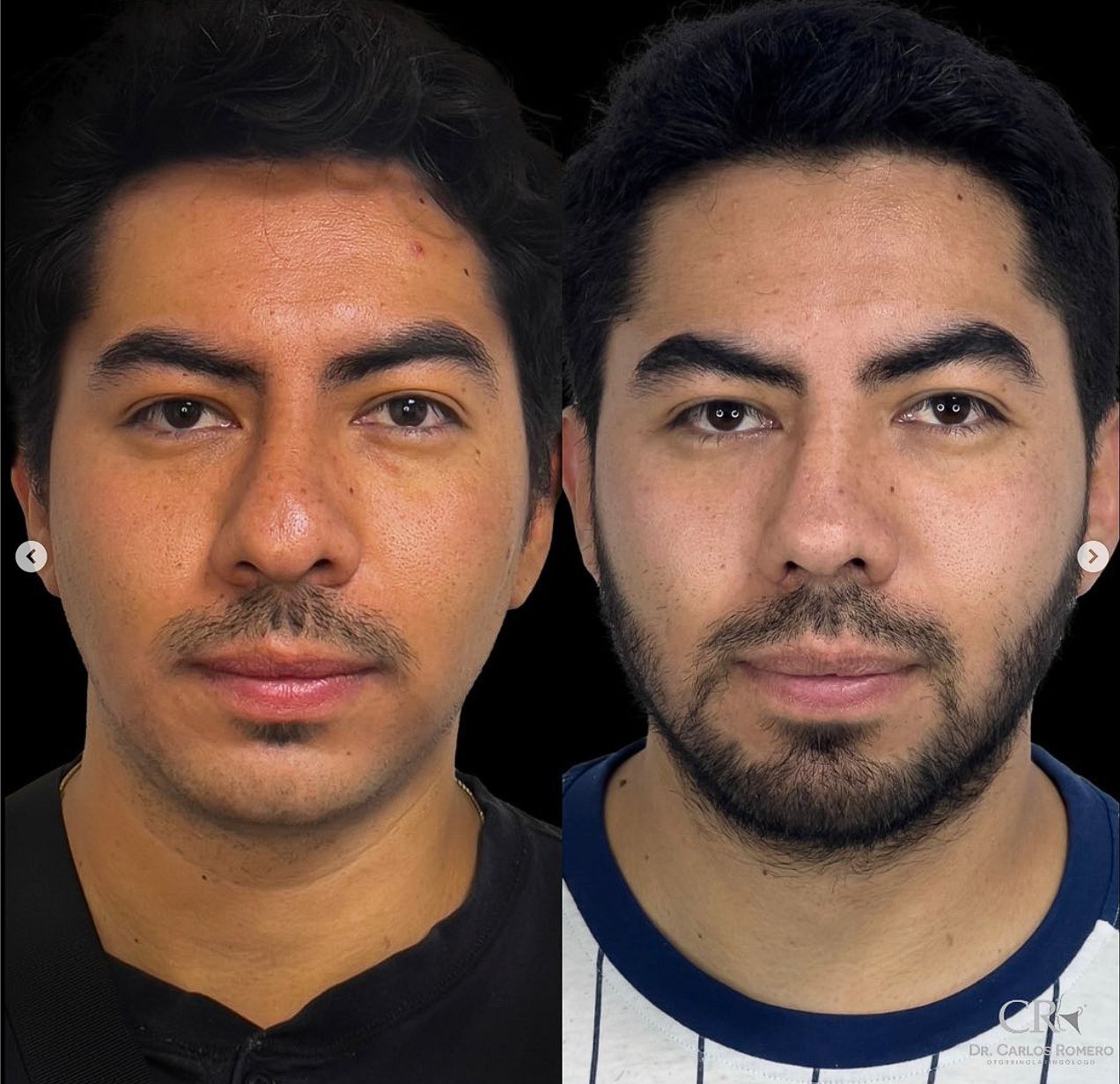 Carlos Alfonso Romero Gameros-23