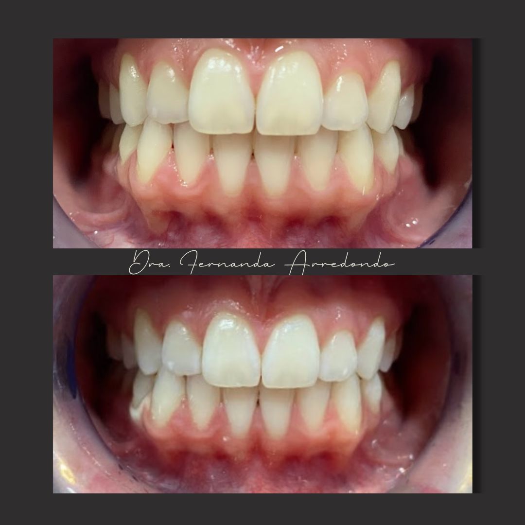 Fernanda Arredondo-4