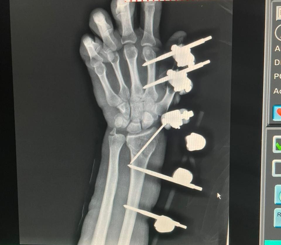 Max Georges Sainte Bernal-6