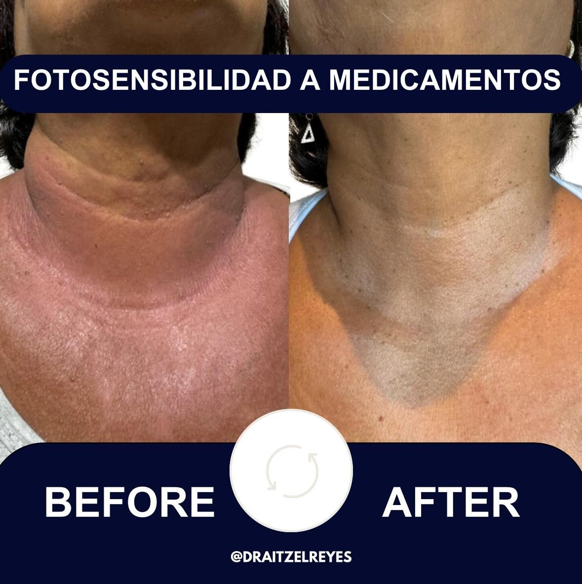 Itzel Anayn Flores Reyes-33