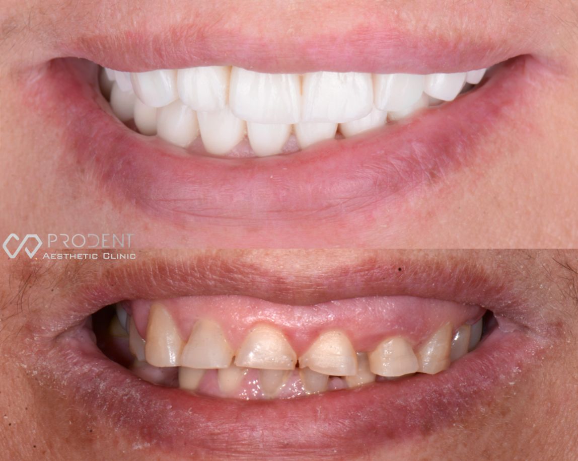 Ulises Pérez Murillo-79