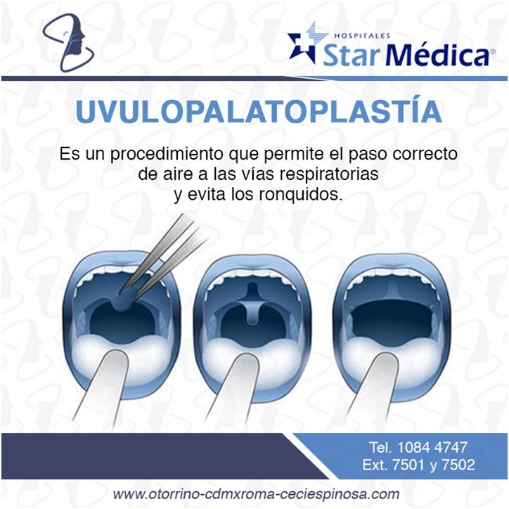 Cecilia Belen Espinosa Arce-20