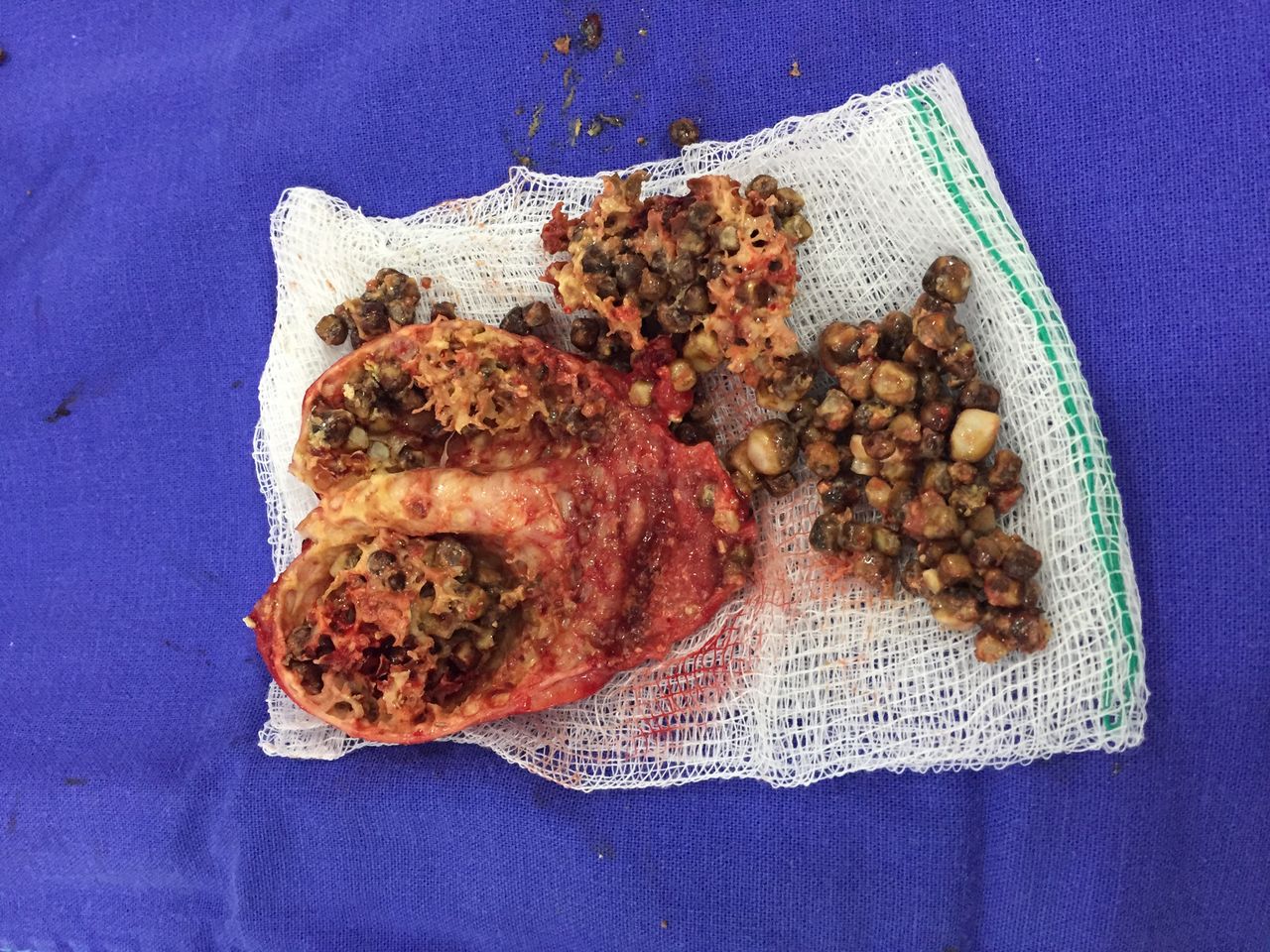 Ferstman Duran Hernandez-5