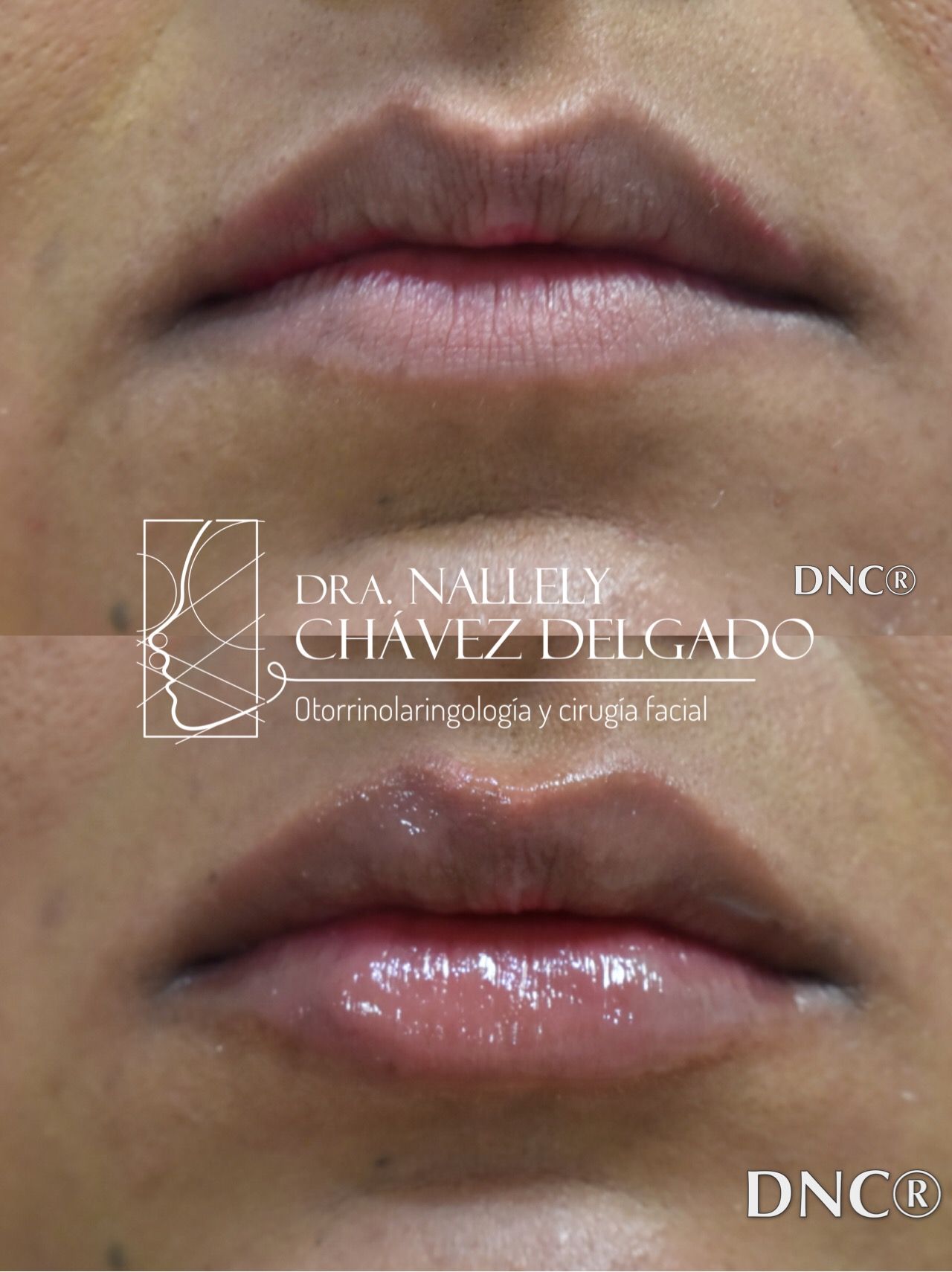 Nallely Chávez Delgado-5