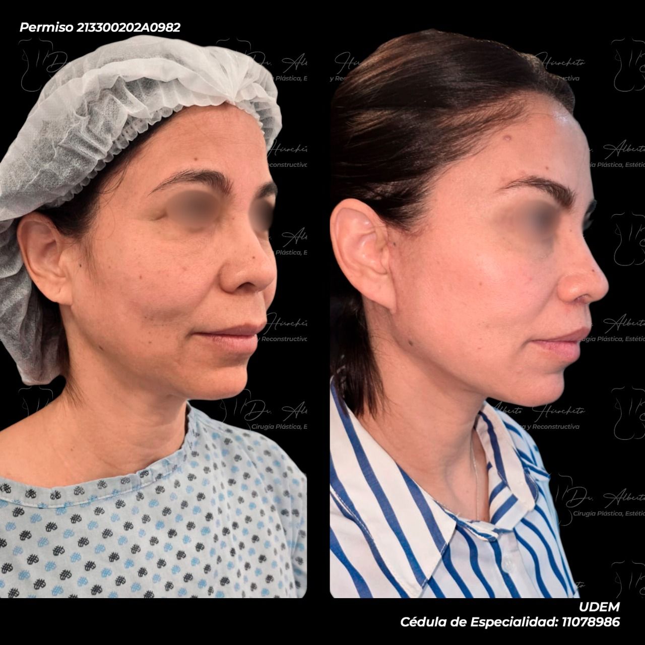 Alberto Hiracheta Torres-27