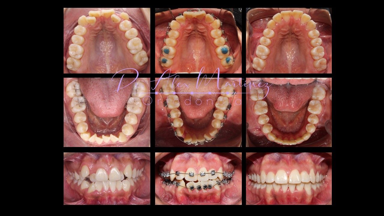 Alejandro Martínez Hernández-4