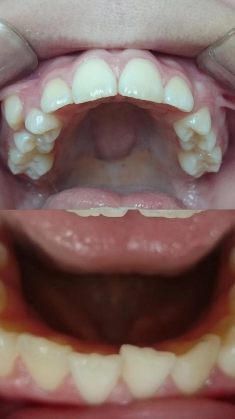 Reyes Silverio Lozano Reza-1