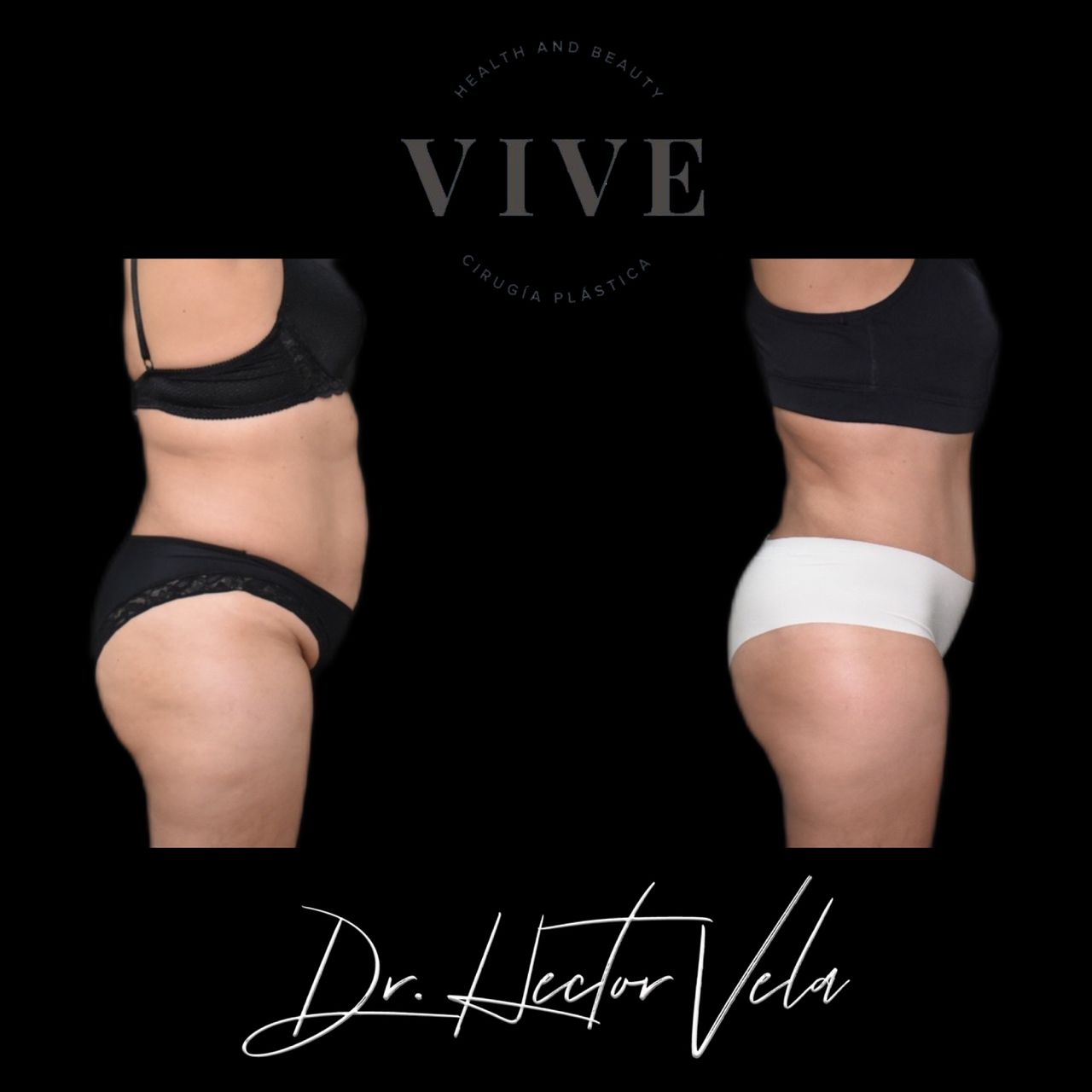 Héctor Eduardo Vela Cardona-81