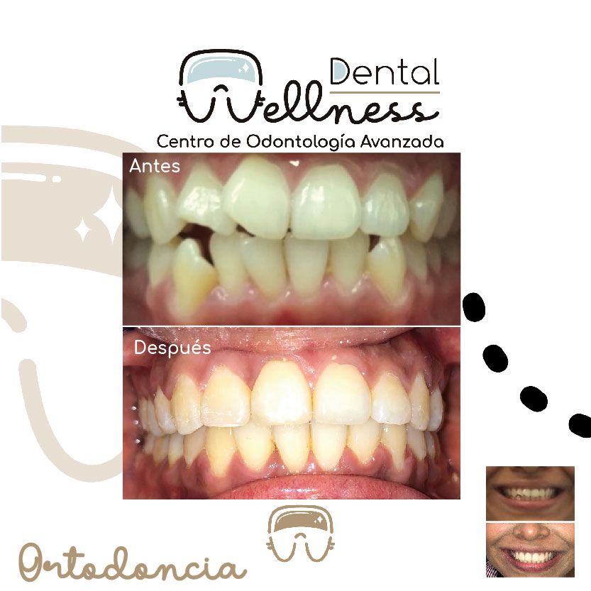 Leticia Hernández-17