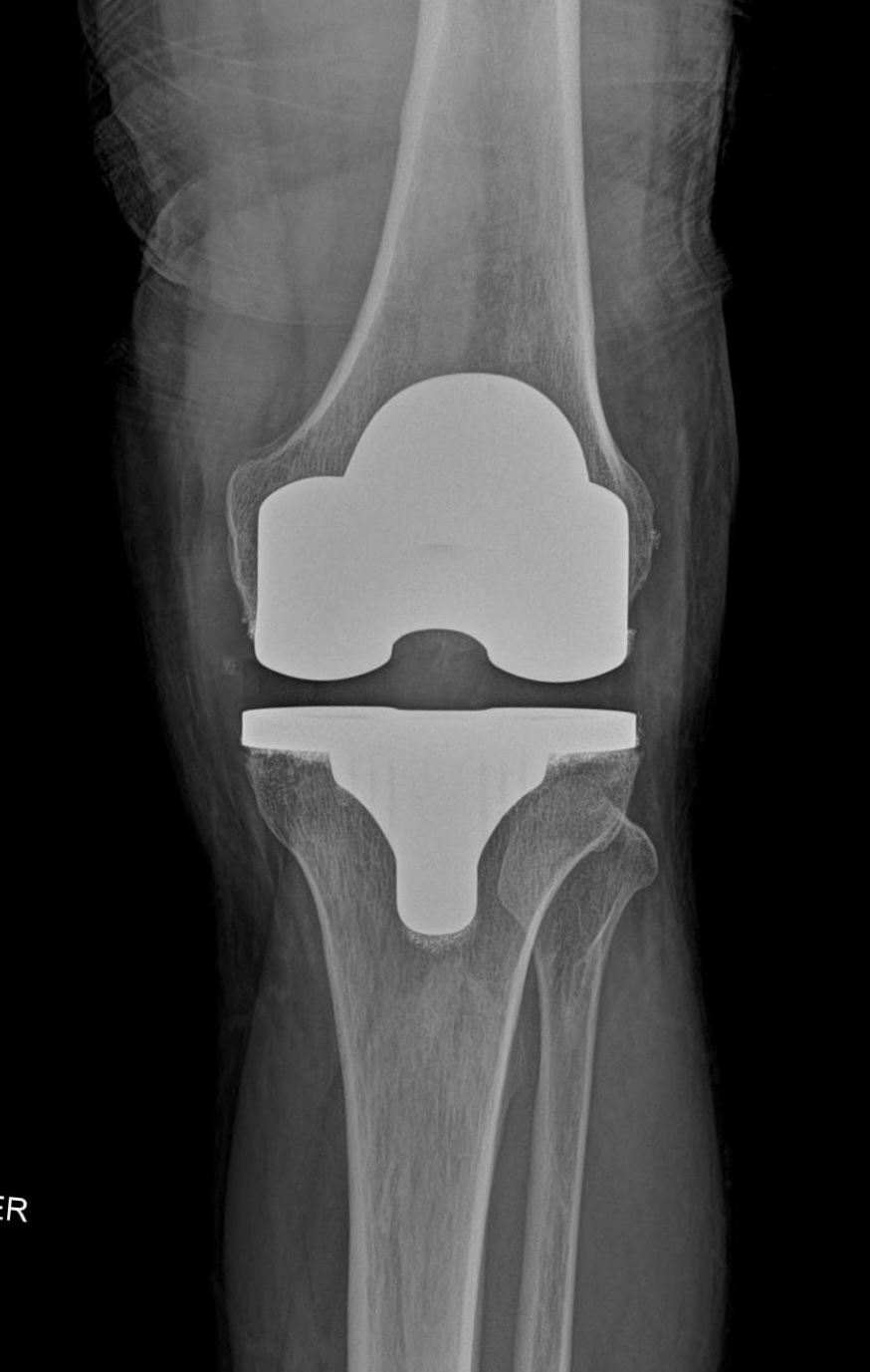 Alejandro Martínez Ramírez-38