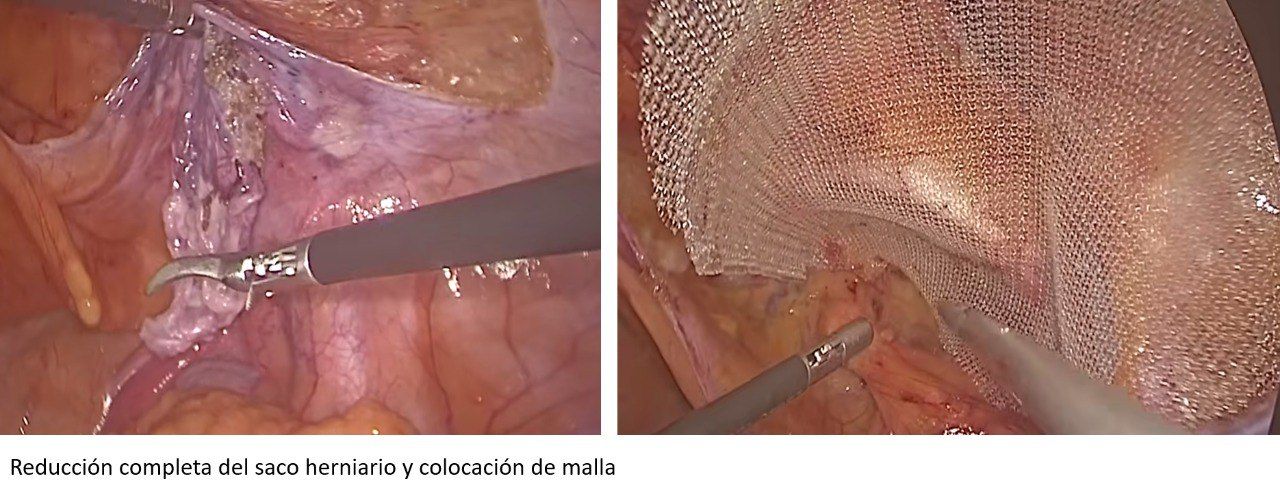 José Miguel Romero De La Vega-3