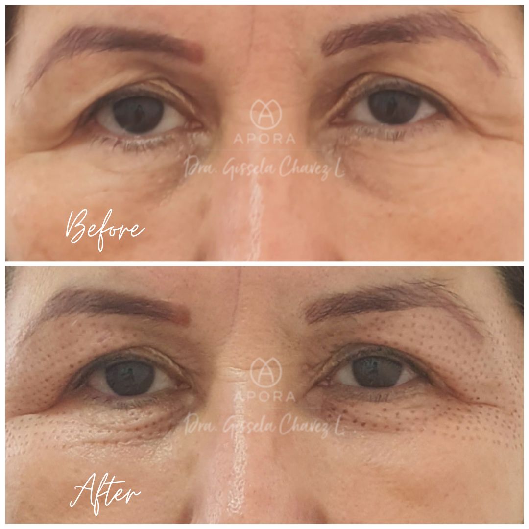 Gissela Chávez Lizardi-24