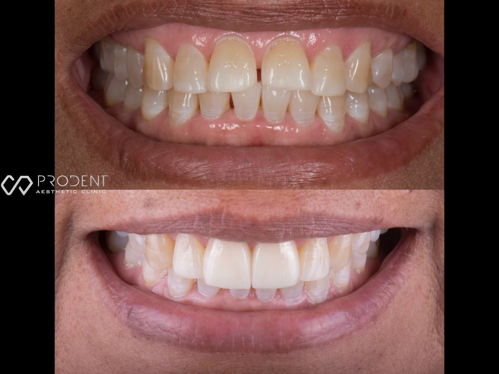 Ulises Pérez Murillo-61