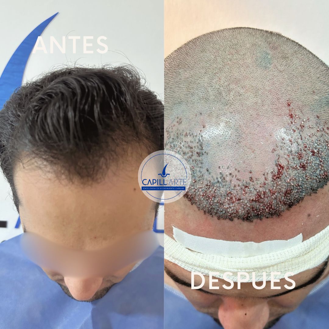 Adrian Hernandez Lopez-38